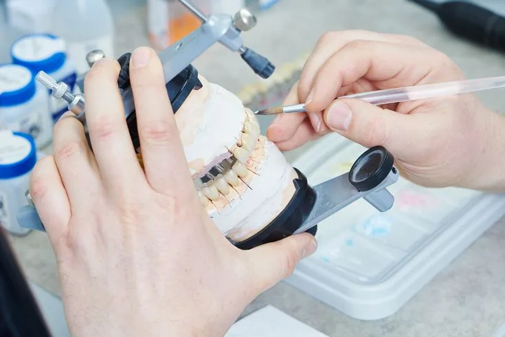 Maxillofacial Prosthetics