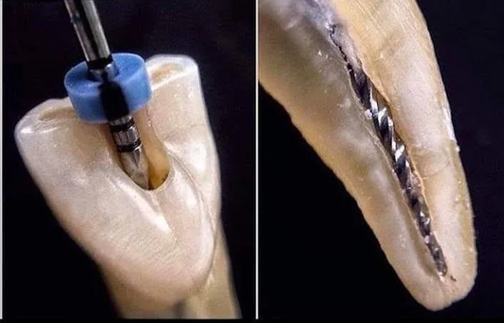 Endodontics